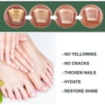 thumbnail image 4 of Nail Fungus Treatment, 50ml Toenail Fungus Treatment, Extra Strong Nail Repair Solution with Natural Tea Tree Oil Extract, 4 of 5