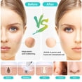 thumbnail image 3 of Blackhead Remover Pore Vacuum with Camera, Facial Pore Cleaner, Electric Acne Comedone Whitehead Blackhead Extractor with 4 Rubber Probes, Visible HD Pore Vacuum Remover, 3 of 7