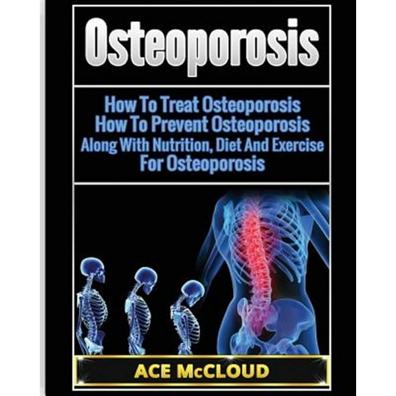 Pre-Owned Reverse or Prevent Bone Loss from Osteoporosis All: Osteoporosis: How To Treat Osteoporosis: How To Prevent Osteoporosis: Along With Nutrition, Diet And Exercise For Osteoporosis (Paperback)