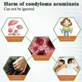 thumbnail image 4 of 6pcs 20g Herpe genital removedor de verrugas ungüento etiqueta de piel Mole acuminatum tratamiento, 4 of 4