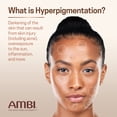 thumbnail image 4 of Sérum Ambi Even & Clear Fade Hyperpigmentation 30 ml, 4 of 8