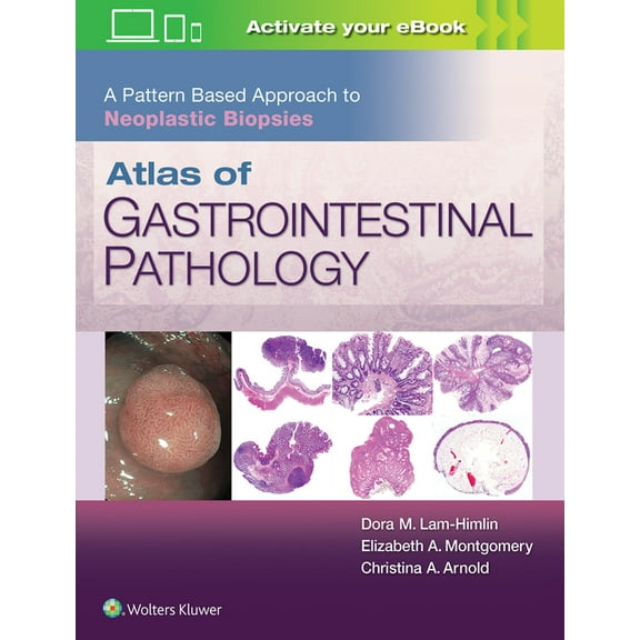 Atlas of Gastrointestinal Pathology: A Pattern Based Approach to Neoplastic Biopsies (Hardcover)