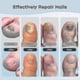 thumbnail image 4 of Nail Fungus Laser Treatment Device for Toenails & Fingernails, Home Use 905nm Infrared Light + 470nm Blue Light for Nail Repair 2025, 4 of 5