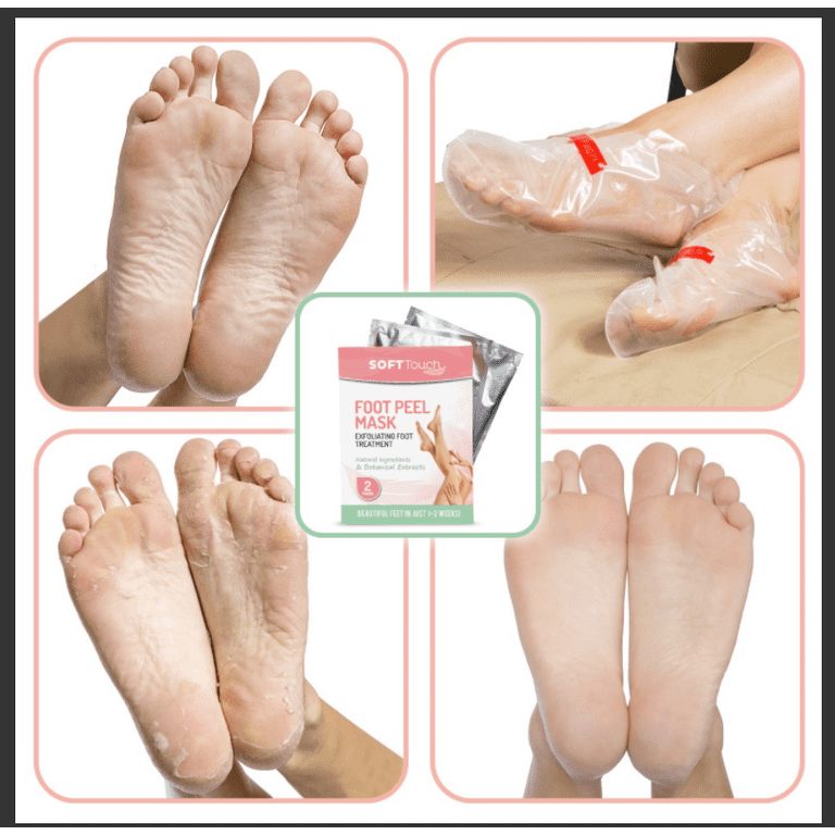 Sheeky Foot™ Exfoliating Foot Peel and Callus Remover – Skin Sheek