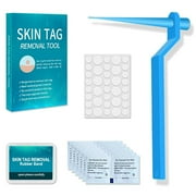 Skin Removal Kit Tools Accessory for Home Use, Safe and Effective Remover for Medium and Small