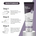 thumbnail image 6 of Marie Originals Skin & Nail Fungus Removal Cream – Plant-Powered Formula for Rapid Relief of Jock Itch, Ringworm, Anti-Itch, Skin & Nail Fungus – Fast Recovery Herbal Solution – 1 oz, 6 of 9