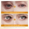 thumbnail image 6 of Intensed Eye Repair And Firming Cream Eliminates Eye Bags Fine Lines And Wrinkles For Brighter More Eyes 20g, 6 of 7