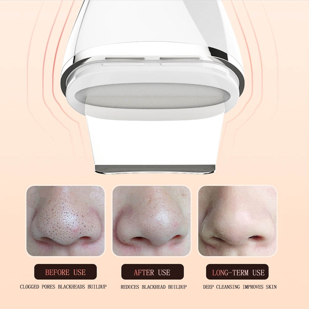Facial Skin Cleaner - Pore Cleaner Blackhead Remover with 4 modes, deep cleansing and skin repair, beauty enhancement tools