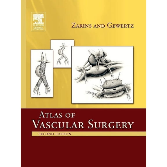Atlas of Vascular Surgery - Paperback Edition, (Paperback)