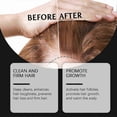 thumbnail image 4 of Hoegoa Rice Shampoo for Scalp Cleaning, Nourishing Hair, Repairing Hair Follicles, Smooth Hair Hair Shampoo, 4 of 5
