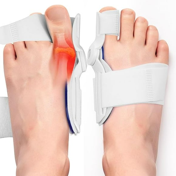 Bunion Corrector 2 Pack for Women and Men, Adjustable Bunion Splint with Non-Slip Big Toe Separators, Comfortable for Day/Night Use
