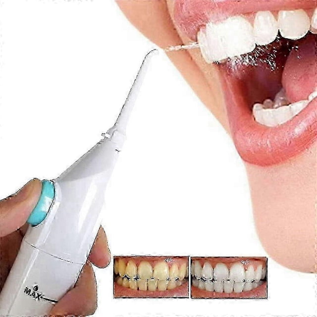 Portable Flosser Dental Water Jet-no Batteries Or Cords Air Powered Dental Water Jet