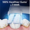 thumbnail image 2 of iO Series Gentle Cleaning Electric Toothbrush Replacement Brush Heads for Oral B Electric Toothbrush, White - 4 Count (Work with iO Series Only), 2 of 6