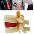 thumbnail image 4 of Transemion Flexible And Compact Anatomical Spine Lumbar Disc Model Versatile And Practical For Training yellow 1Set, 4 of 6