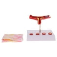 thumbnail image 5 of Equipment Human Vessel Atherosclerosis \ U0026 Thrombus Model School Teaching, 5 of 8