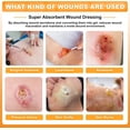 thumbnail image 7 of Carbou 6"x 6" Super Absorbent Wound Dressing Pads, 10pcs Non Adhesive Absorbent Bandages for Wound Care, 7 of 7
