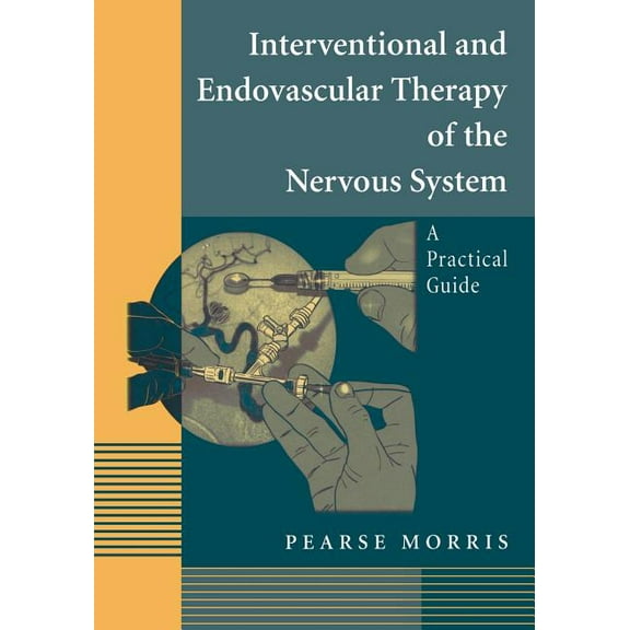 Interventional and Endovascular Therapy of the Nervous System: A Practical Guide, (Paperback)