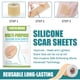 thumbnail image 2 of Hojas de silicona para cicatrices de 150cm, parches de Gel ajustables, pegatinas para eliminar cicatrices, parche de terapia para el acné, trauma, quemadura, cicatriz, reparación de la piel Sincero Hogar, 2 of 5