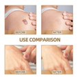 thumbnail image 2 of Cinta adhesiva para cubrir tatuajes, tiras de maquillaje impermeables de aspecto natural, cinta adhesiva transpirable para cubrir tatuajes, maquillaje para ocultar cicatrices y tatuajes no deseados, 6, 2 of 5