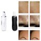 thumbnail image 2 of Pala ultrasónica Instrumento de limpieza de la piel Instrumento de belleza 1 pieza negro, 2 of 2