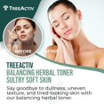 thumbnail image 2 of Hidratante facial a base de hierbas Toner TreeActiv 118 ml, 2 of 7