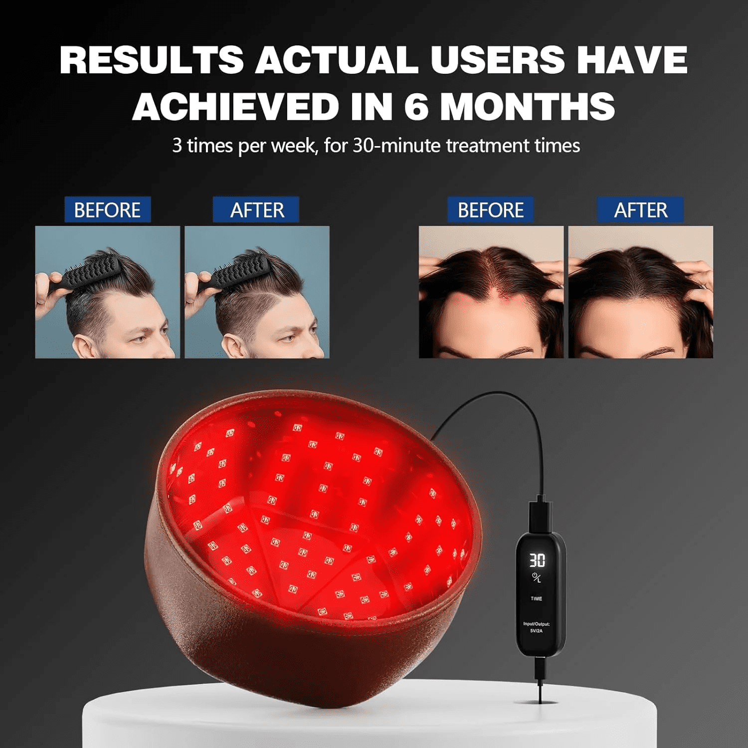 Wearable Scalp Care Helmet with Red Light, Discreet Hands-Free Light Device for At-Home Hair Wellness Routines, Full Coverage, Brown