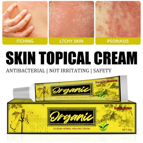 Best Eczema Cream