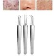 thumbnail image 2 of 3 piece blackhead removal clip8.7cm, stainless steel beveled acne clip, cotton tweezers, beauty acne needle, easily remove tiny acne, remove acne blac, 2 of 4
