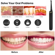 Plaque Remover for Teeth, Electric Dental Calculus Remover with 3 Modes 3 Heads LED Light, Teeth Cleaning Tools Kit, Safe for Both Adult Kids (Black)