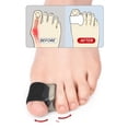 thumbnail image 6 of Foot Gel Toe Separators for Overlapping Toes Bunions Big Toe Alignment Corrector and Spacer Hallux Valgus Orthosis, 6 of 8