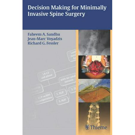 Decision Making for Minimally Invasive Spine Surgery -
