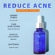 thumbnail image 4 of Hot6sl Liquidación de Ahorros de Verano Líquido Hidratante para Cuidado Facial con Vitamina C, 30 Ml, 4 of 7