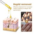 thumbnail image 5 of Suero de brillo rápido para nudillos oscuros, suero para aclarar codos, nudillos de mano, rodilla, piel negra, aclara rápidamente las manchas, esencia eliminadora, 5 of 5