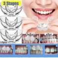 thumbnail image 1 of 2024 Dental Orthodontic Teeth Corrector Silicone Braces Retainer Straighten Tools Teeth Capped for Adults, 1 of 5