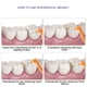 thumbnail image 5 of L Shape Push-pull Interdental Brush Orthodontic Toothpick Teeth Whitening Tooth Pick Toothbrush Oral Hygiene Care, 5 of 5