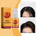 thumbnail image 4 of Fiudx Champú Seco, Capilar Revitalizado de Fórmula Natural, Producto de Peinar y Absorbente La Grasa, Ideal de Gimnasios Al Aire, Solución de Mañanas Agitadas, Aerosol de 60 Ml, Ingredientes de Ecoló, 4 of 7