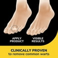 thumbnail image 4 of Dr. Scholl's Clear Away® Wart Remover Hydrogel Bandages, 12 Discs, 9 Pads, 4 of 10