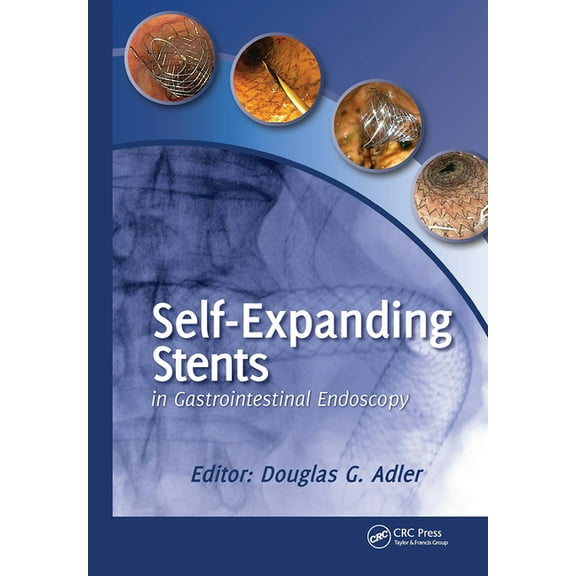 Self-Expanding Stents in Gastrointestinal Endoscopy, (Hardcover)