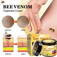 thumbnail image 2 of Tratamiento integral para la piel Cream Flysmus Bee Venom de 50 ml, 2 of 7
