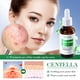 thumbnail image 5 of Fiudx Ofertas y liquidaciones Suero reparador Centella Asiatica Hidrata, humecta, estabiliza, repara y fortalece la base 30 ml, 5 of 7