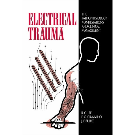Electrical Trauma: The Pathophysiology, Manifestations, and Clinical Management, (Hardcover)