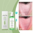 thumbnail image 5 of Prix Réduit Naittoop Ensemble de Gel Nettoyant Buccal Nettoie Efficacement le Revêtement de Langue et Restaure la Fraîcheur Buccale avec une Utilisation Continue, 5 of 5