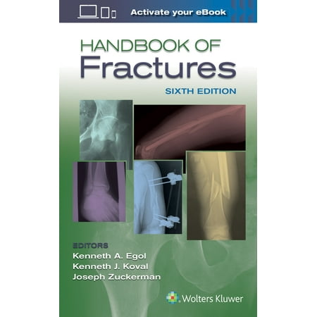 UPC: 9781496384850 | Handbook of Fractures