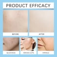 thumbnail image 3 of Hoygi 2% Salicylic Acid Balancing Repair Serum, Moisturizing And Improving Acne Closing Essence, 3 of 6