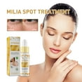 2 Pack Milia Spot Treatment Helps Dissolve and Reduce Milia, Milia