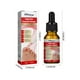 thumbnail image 4 of Suavizante de uñas encarnadas Suero Corrección de uñas Recuperar Aceite Analgésico Likrtyny  Cuidado Belleza, 4 of 6