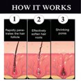 thumbnail image 3 of Skin Hair Removal Cream, Plant Extracts Hair Removal Cream 3pcs 50g  for Chest, 3 of 8