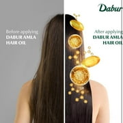 Dabur Amla Hair Oil - Nourishing Indian Oil for Men Women, for Healthy, Moisturized Hair and Scalp (200ml)