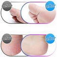thumbnail image 3 of [4 par Paquet] Rouleaux de Remplacement Extra Rugueux, Compatibles avec les Rouleaux de Remplacement Emjoi Micro Pedi., 3 of 5