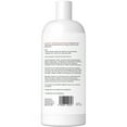 thumbnail image 4 of SensoVet Chlorhexidine 4% Cleansing & Deodorizing Shampoo for Dogs & Cats – Supports Skin Hygiene & Coat Health, 4 of 5